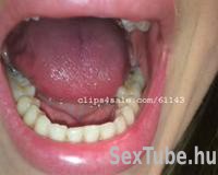 száj, szájfétis, vore, hosszú nyelv, nyelv, fogászati, ajkak